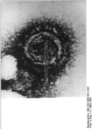 Vergrößerte Darstellung eines Humanen Immunschwächevirus (HIV)