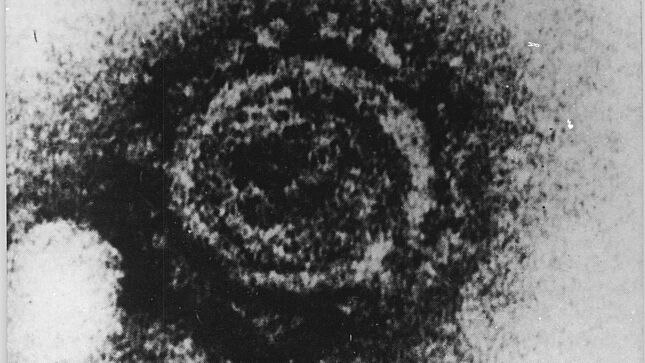 Vergrößerte Darstellung eines Humanen Immunschwächevirus